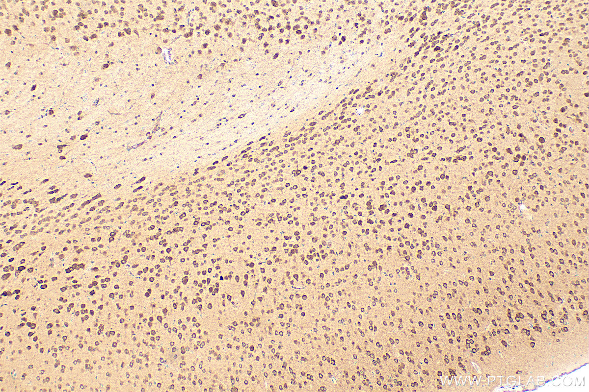 IHC staining of mouse brain using 14155-1-AP