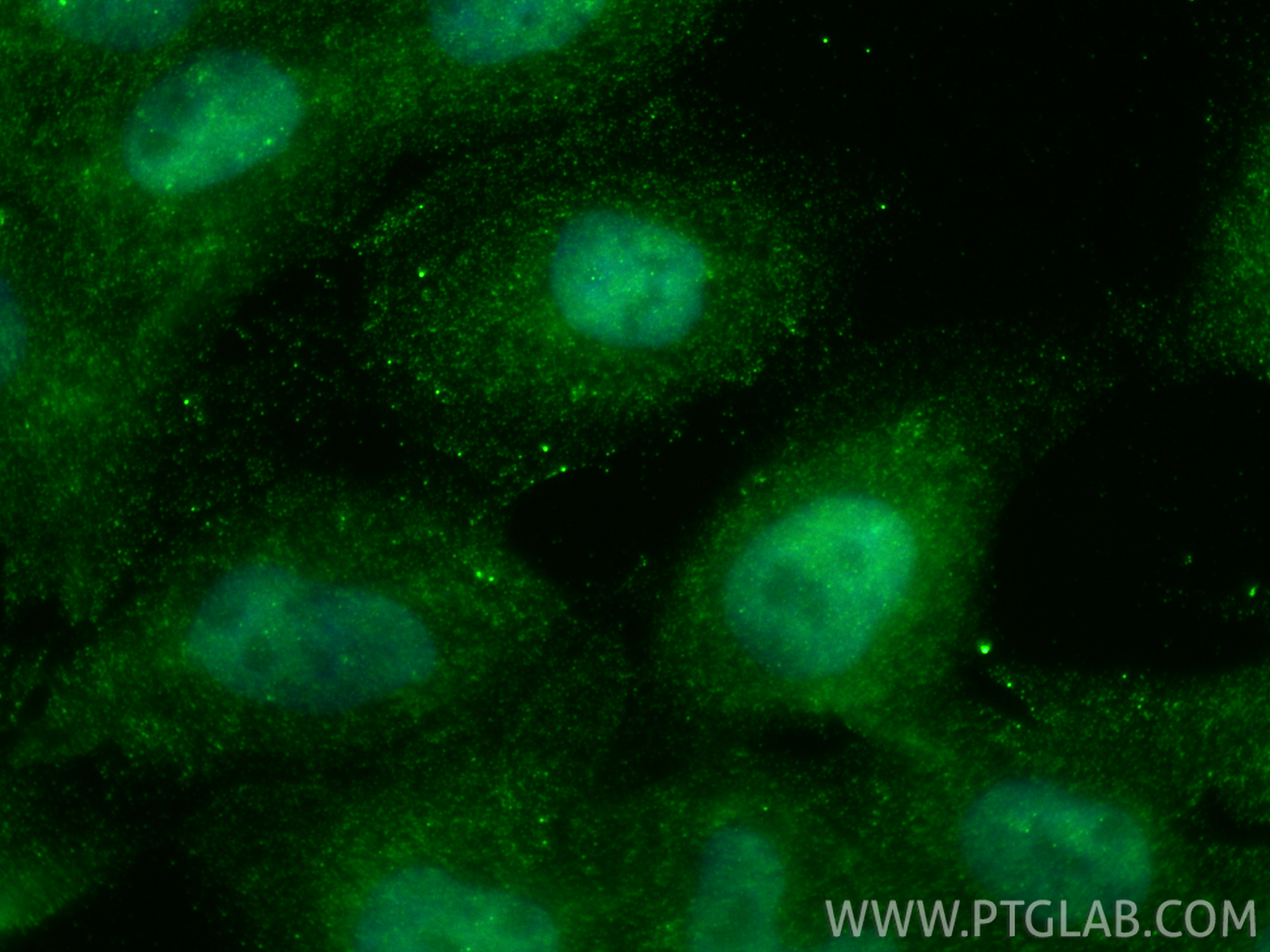 Immunofluorescent analysis of (4% PFA) fixed A431 cells using FKBP5 antibody (<a class='green' href='/productredirect?CatalogNo=67874-1-Ig' target='_blank'>67874-1-Ig</a>, Clone: 3B11F3 ) at dilution of 1:400 and CoraLite®488-Conjugated Goat Anti-Mouse IgG(H+L) (<a class='green' href='/productredirect?CatalogNo=SA00013-1' target='_blank'>SA00013-1</a>). This data was developed using the same antibody clone with 67874-1-PBS in a different storage buffer formulation. IF Staining of A431 using 67874-1-Ig (same clone as 67874-1-PBS)