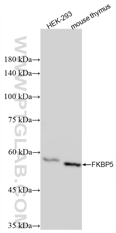 Various lysates were subjected to SDS PAGE followed by western blot with 86189-1-RR (FKBP5 antibody) at dilution of 1:5000 incubated at room temperature for 1.5 hours. WB analysis using 86189-1-RR