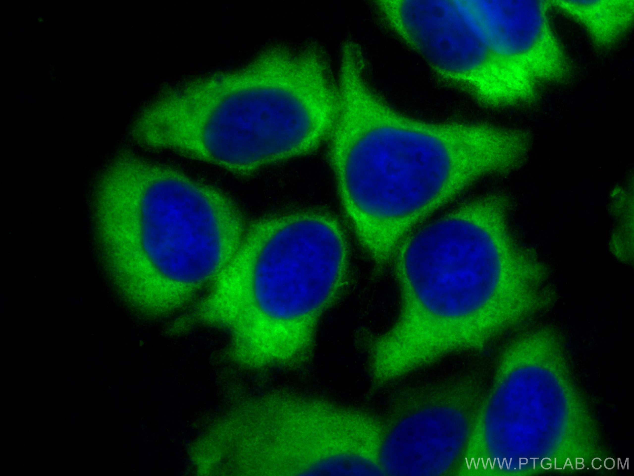 IF Staining of MCF-7 using 10655-1-AP