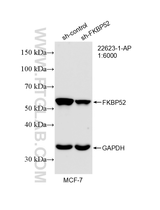 WB analysis of MCF-7 using 22623-1-AP WB analysis of MCF-7 using 22623-1-AP