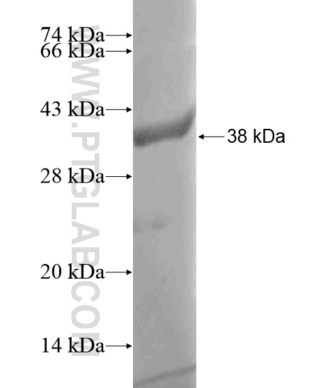 FKBP52 fusion protein Ag18704 SDS-PAGE