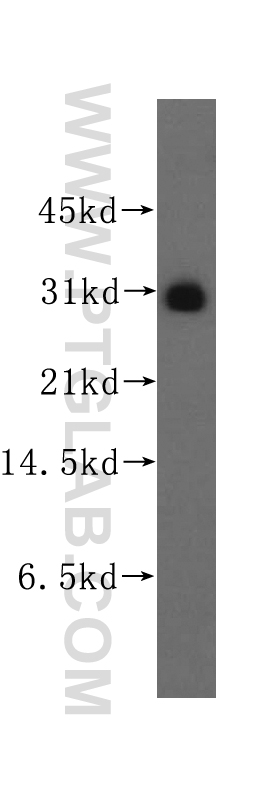 WB analysis of human lung using 12092-1-AP