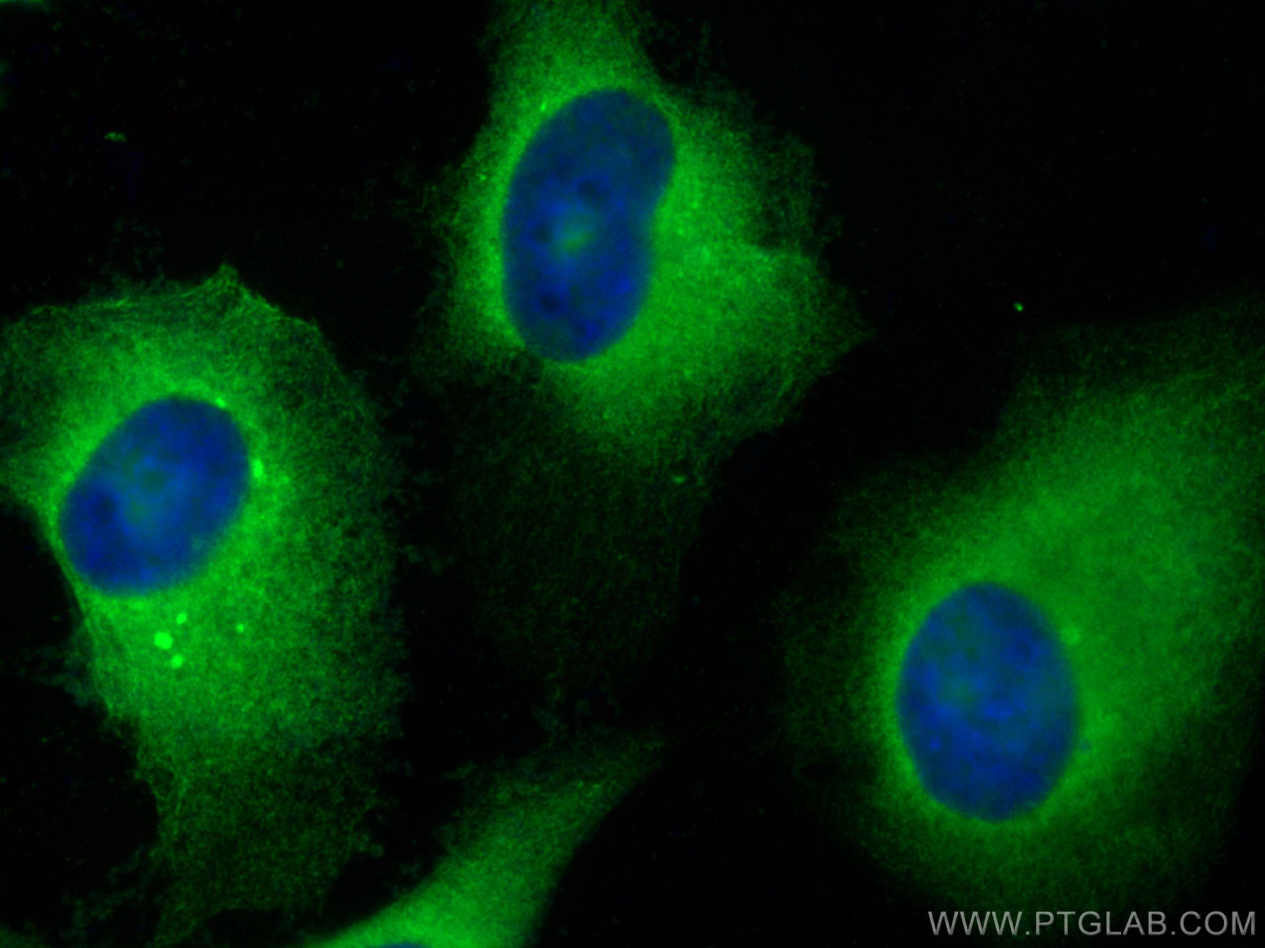 IF Staining of HeLa using 23369-1-AP