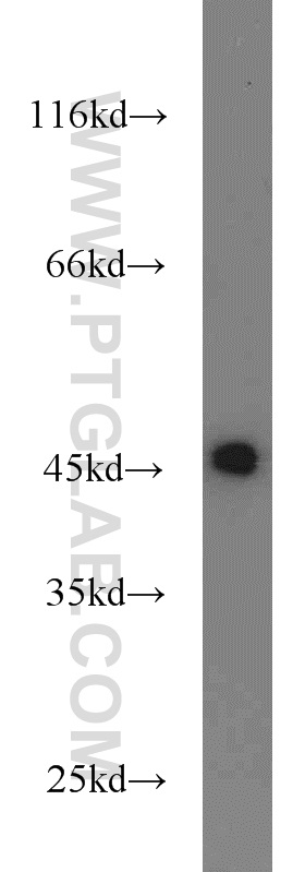 WB analysis of HeLa using 23369-1-AP