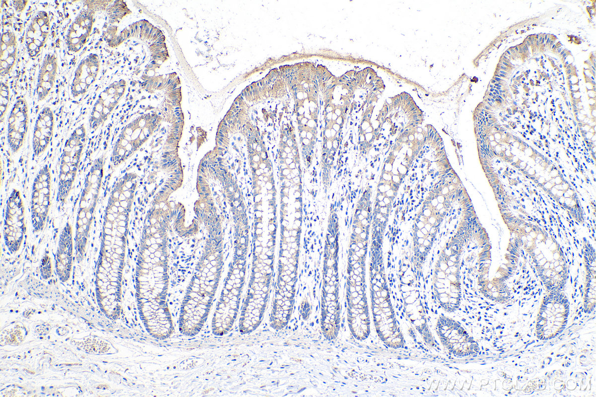 IHC staining of human colon using 18276-1-AP IHC staining of human colon using 18276-1-AP