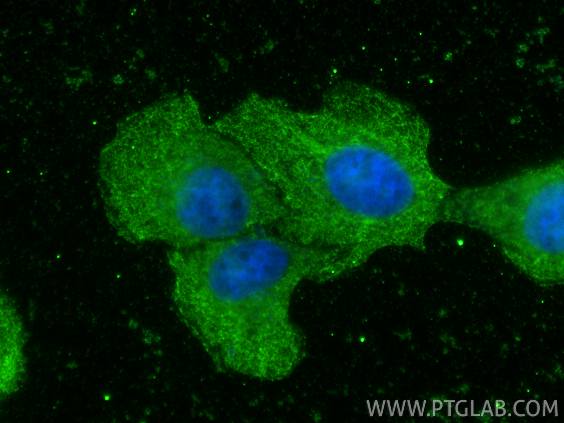 IF Staining of A431 using 68491-1-Ig IF Staining of A431 using 68491-1-Ig