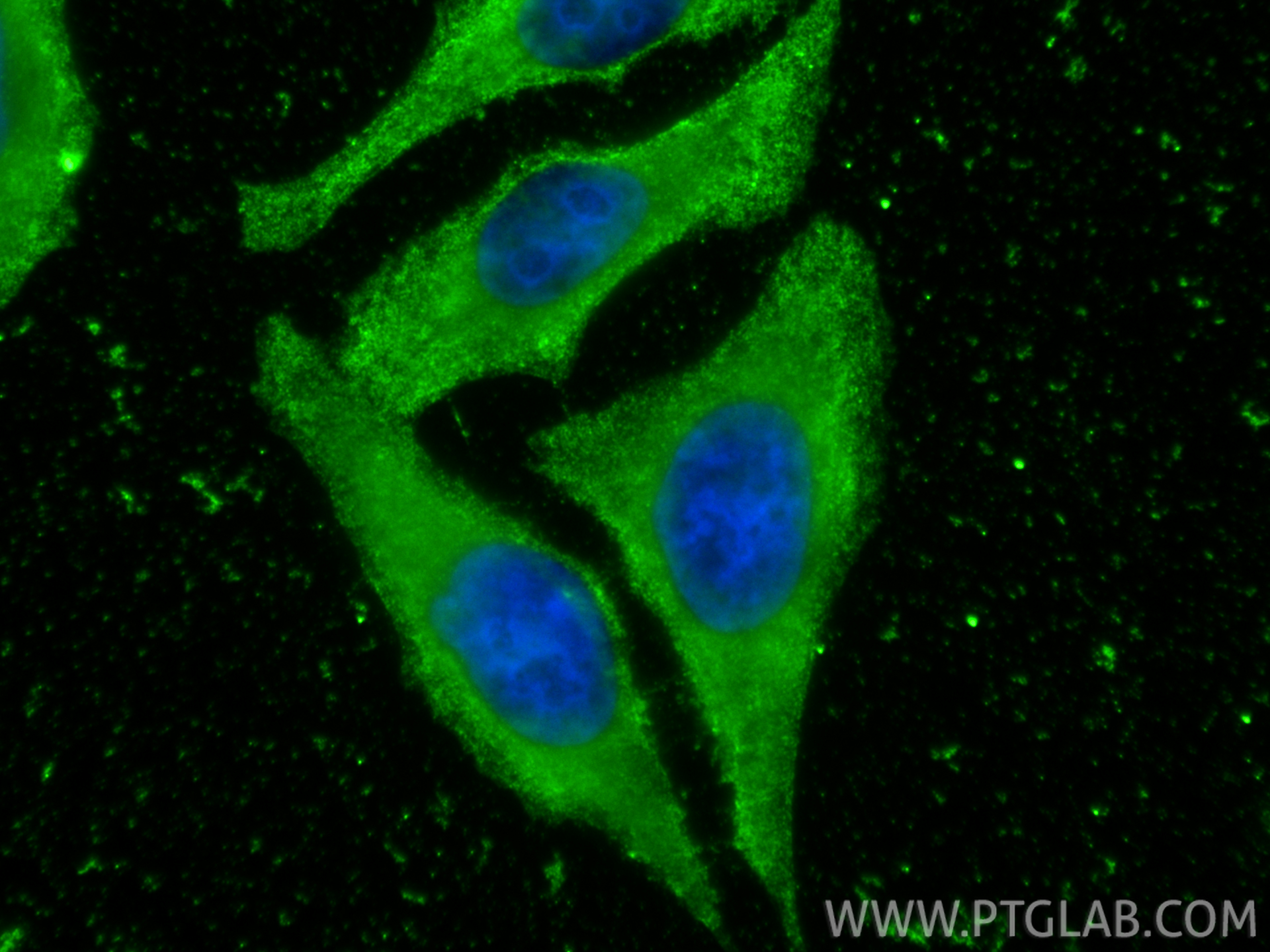 IF Staining of HepG2 using 68491-1-Ig IF Staining of HepG2 using 68491-1-Ig