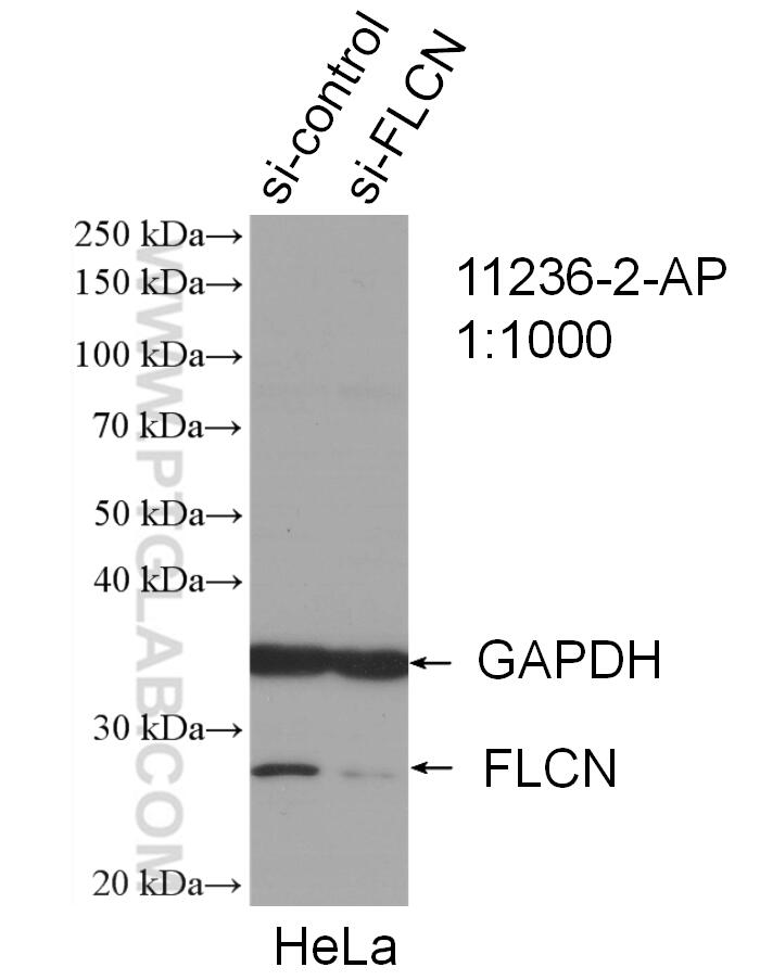 WB analysis of HeLa using 11236-2-AP