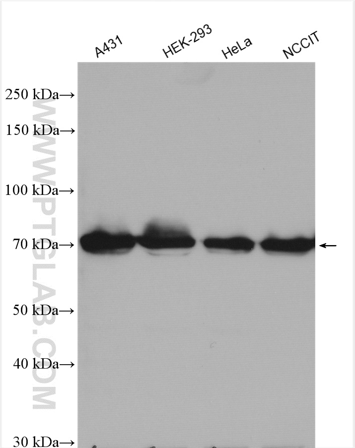 WB analysis using 11236-2-AP