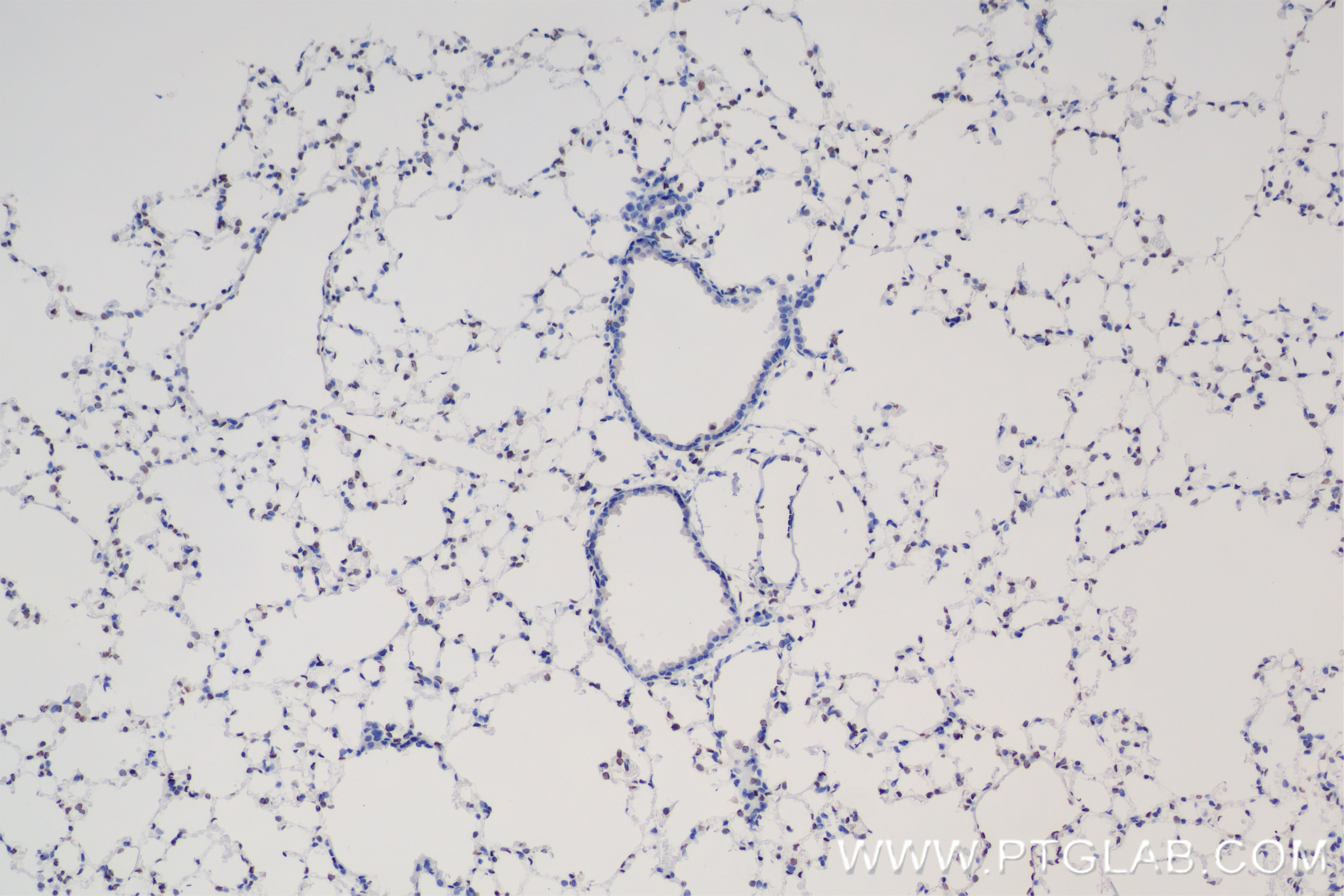 IHC staining of mouse lung using 85931-1-RR