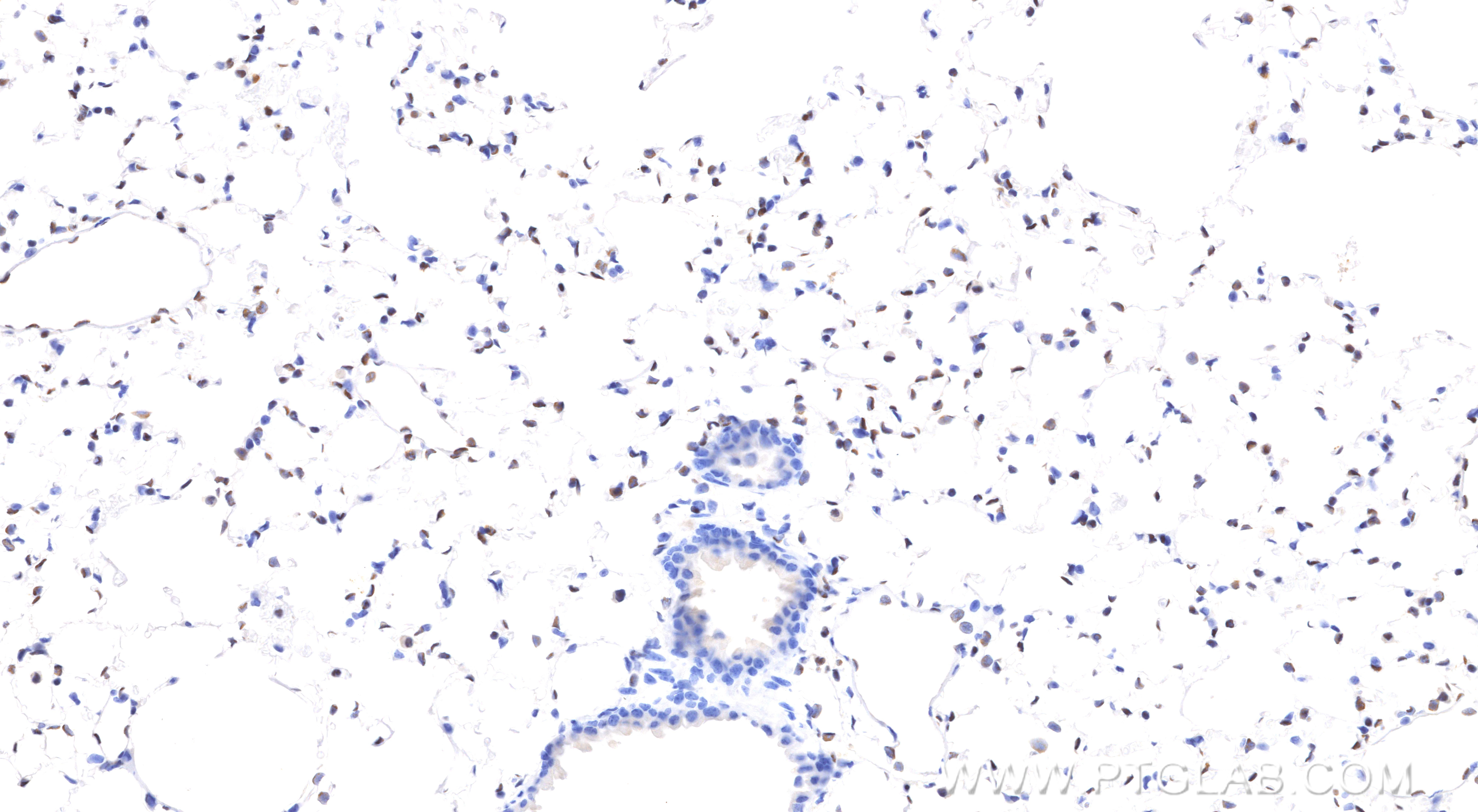 IHC staining of mouse lung using 85931-1-RR