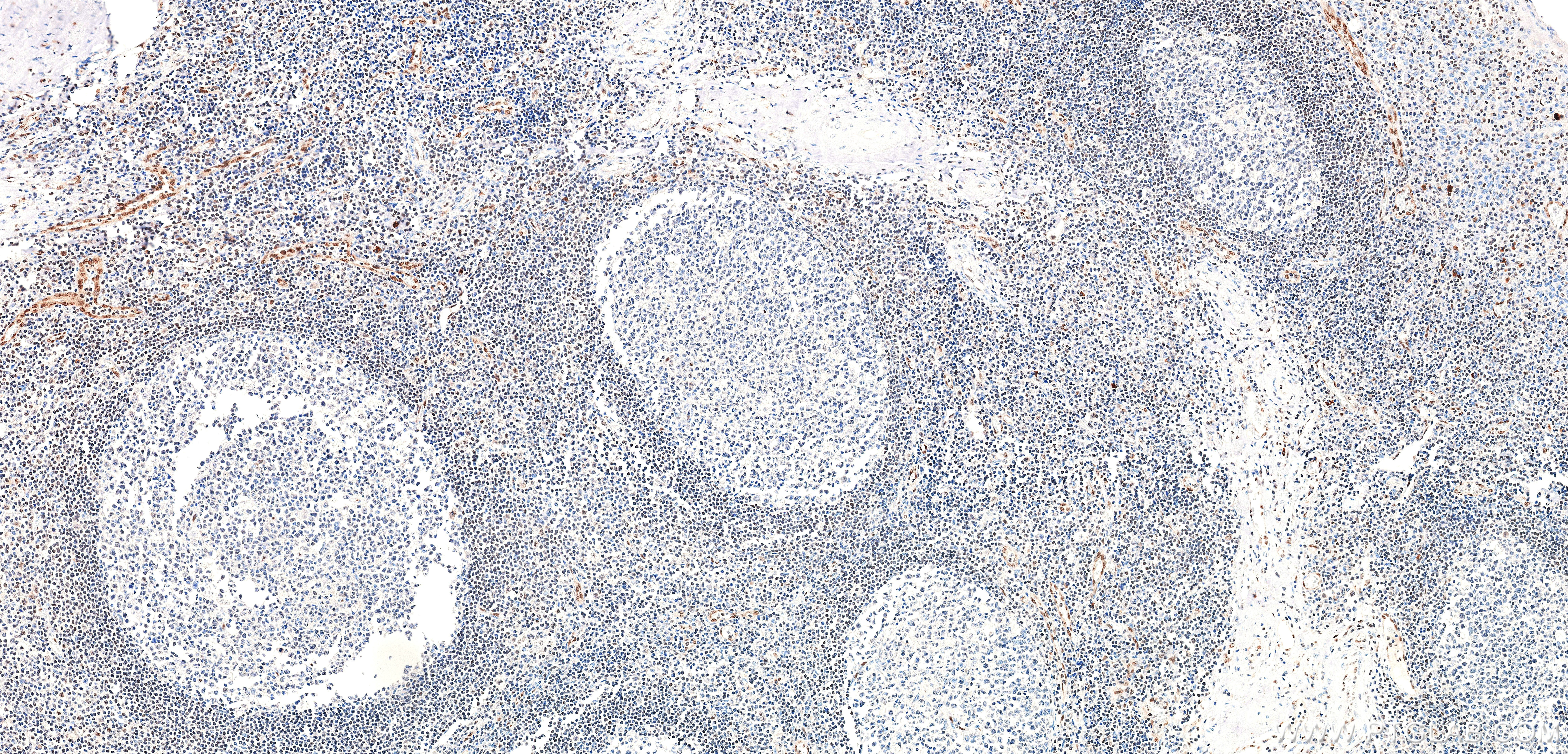 IHC staining of human tonsil using 85931-1-RR