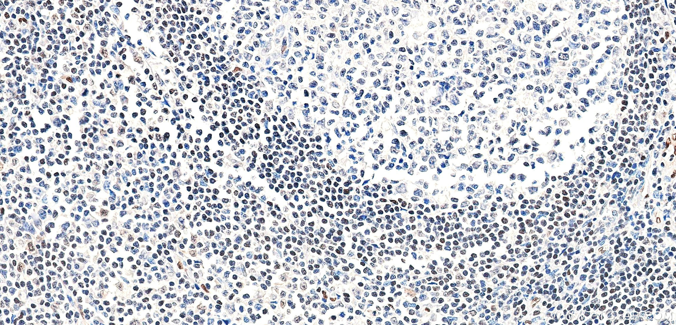IHC staining of human tonsil using 85931-1-RR
