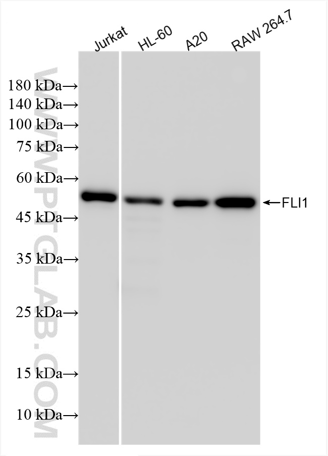 WB analysis using 85931-1-RR