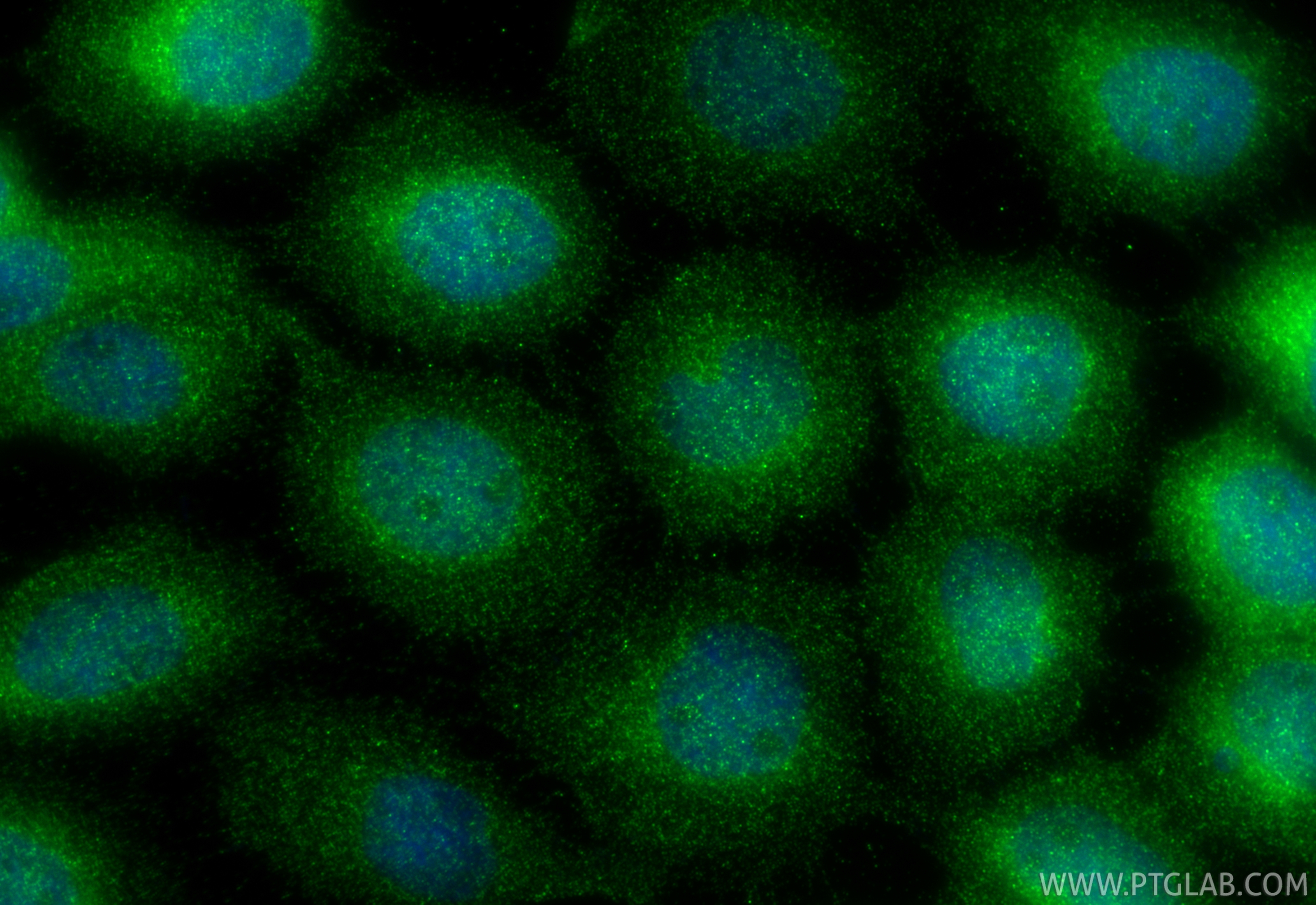 IF Staining of A431 using 67039-1-Ig IF Staining of A431 using 67039-1-Ig
