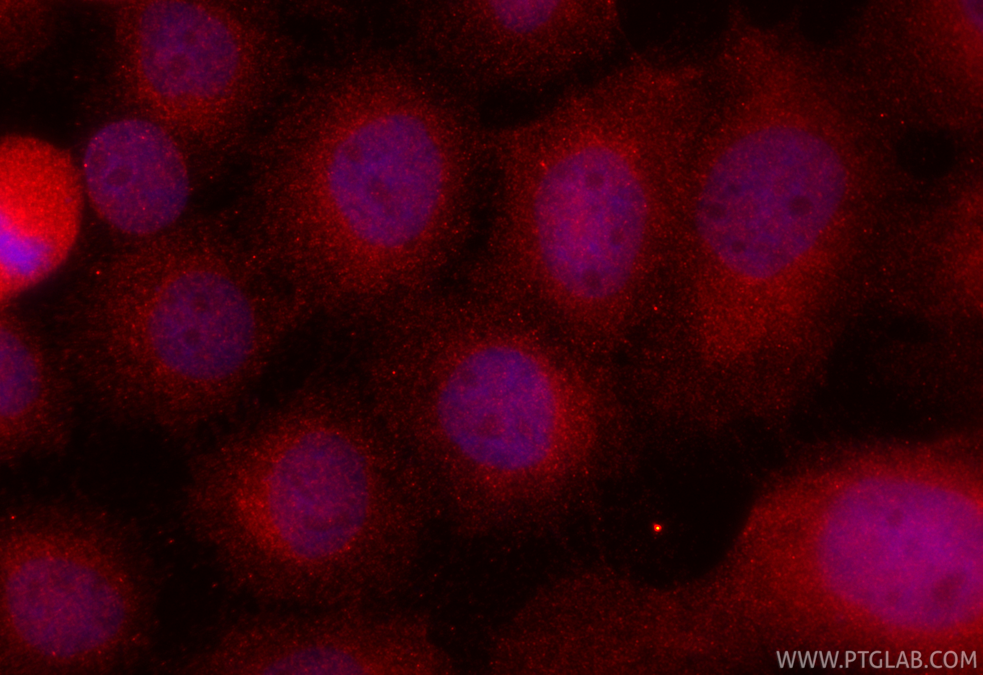 IF Staining of A431 using CL594-67039 IF Staining of A431 using CL594-67039