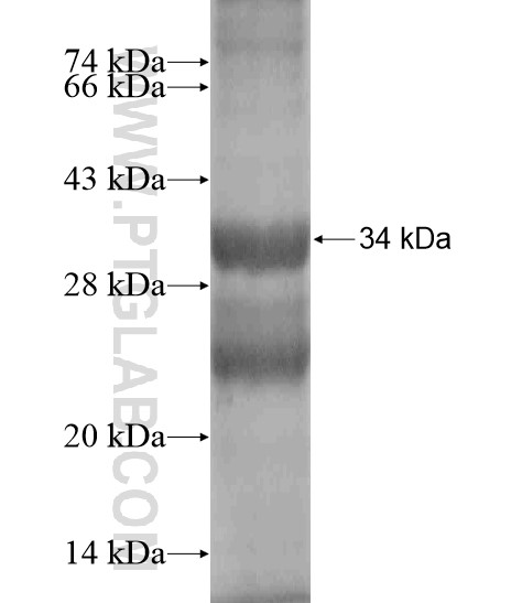 EBLN2 fusion protein Ag19935 SDS-PAGE EBLN2 fusion protein Ag19935 SDS-PAGE