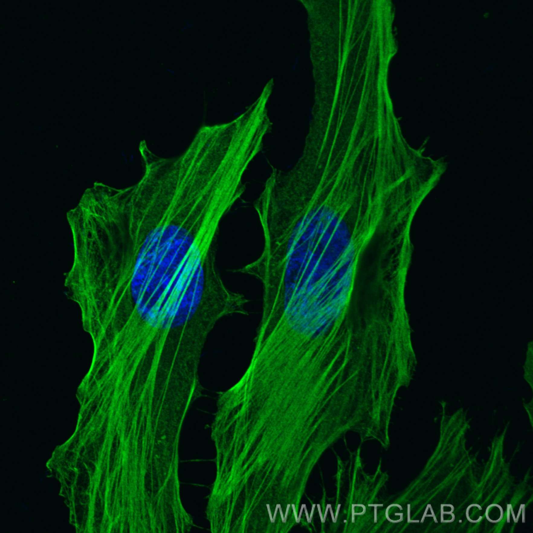 IF Staining of HeLa using 67133-1-Ig