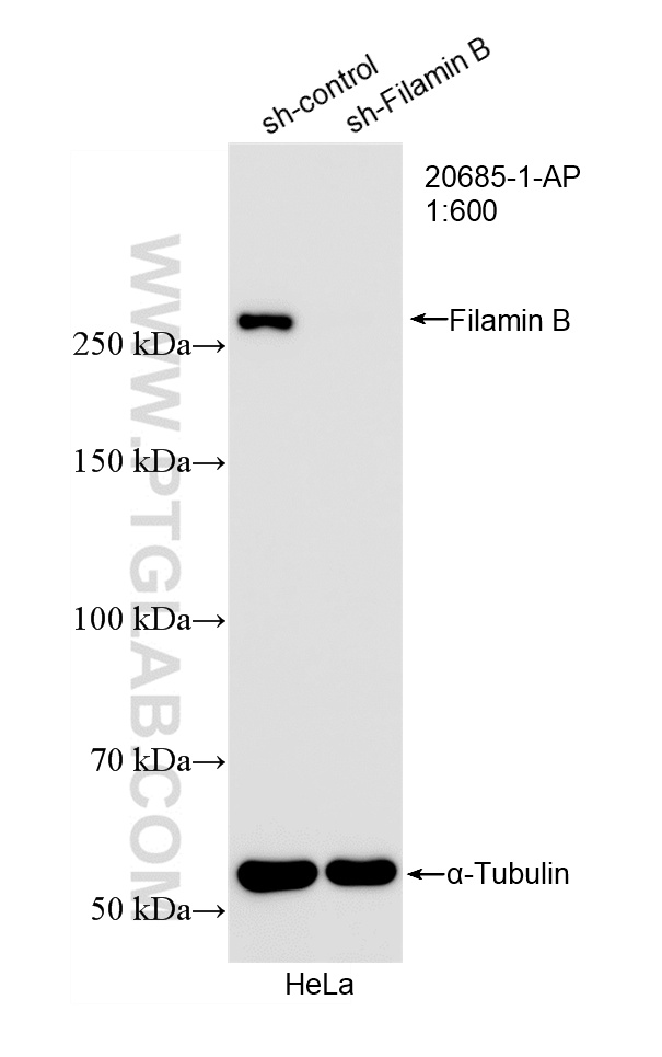 WB analysis of HeLa using 20685-1-AP WB analysis of HeLa using 20685-1-AP