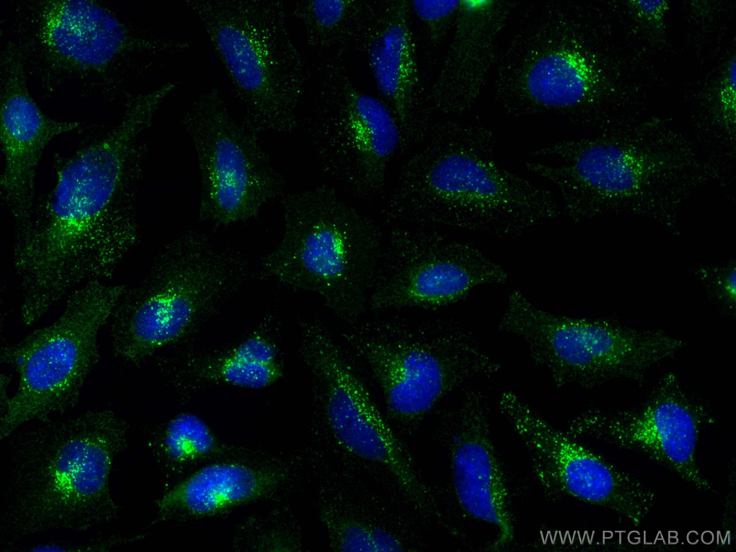 IF Staining of HeLa using 15571-1-AP