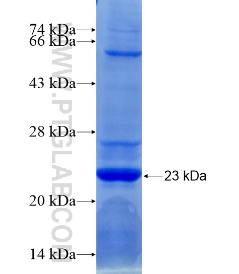 FLRT2 fusion protein Ag19435 SDS-PAGE FLRT2 fusion protein Ag19435 SDS-PAGE