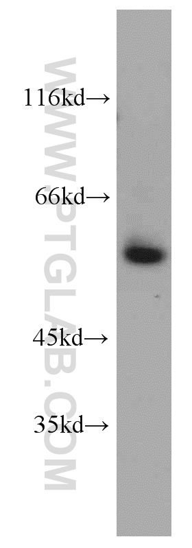 VEGFR-1/FLT-1 Polyclonal antibody