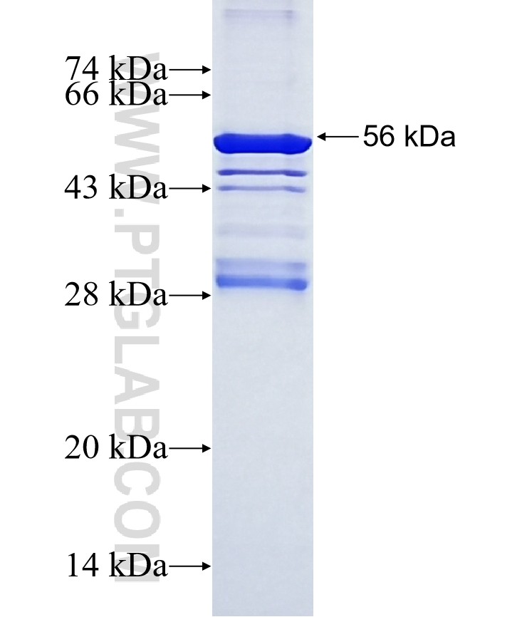 VEGFR1, FLT1 fusion protein Ag4558 SDS-PAGE