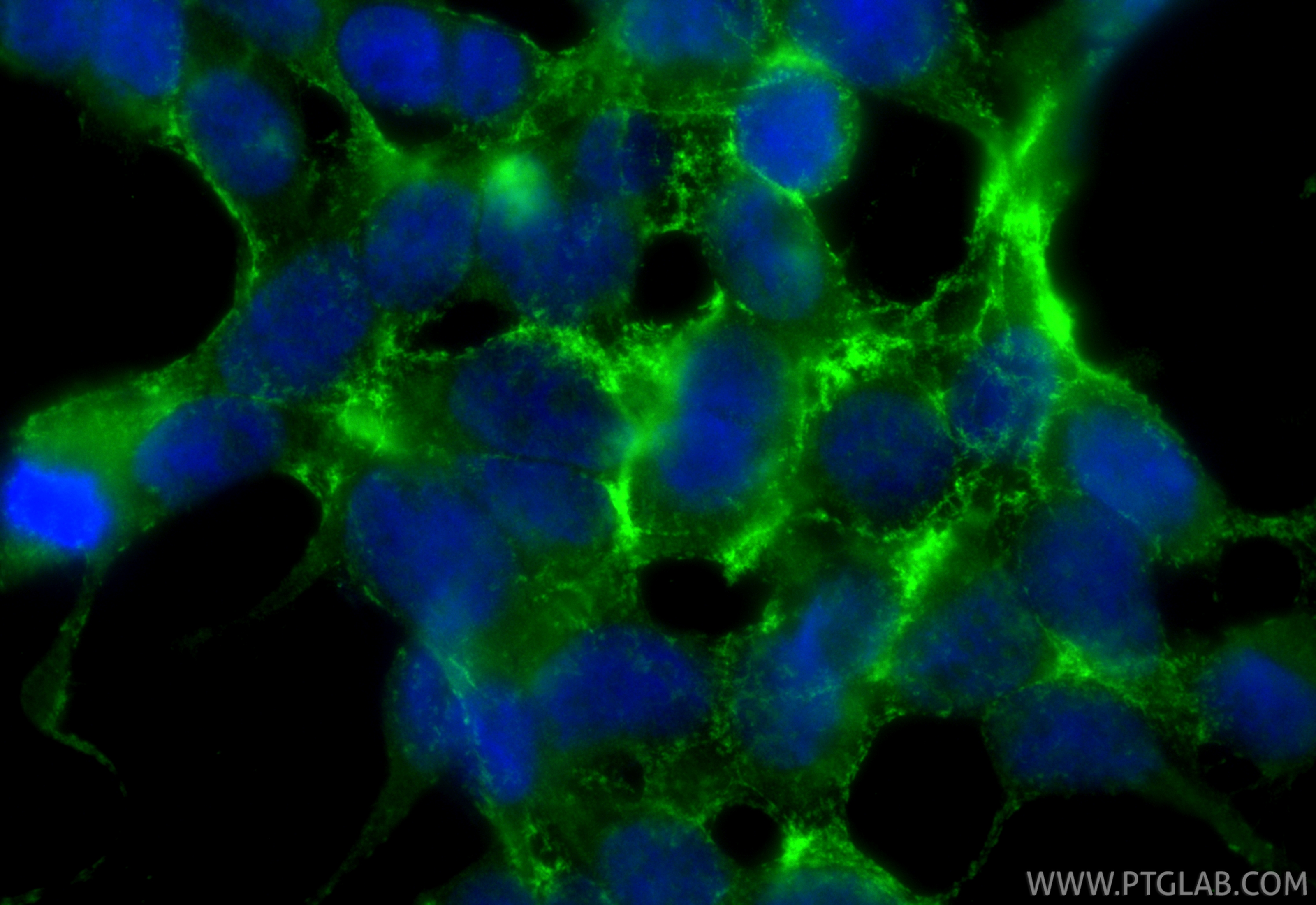 IF Staining of HEK-293 using 30297-1-AP