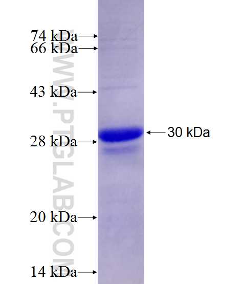 FLT3 fusion protein Ag28112 SDS-PAGE FLT3 fusion protein Ag28112 SDS-PAGE