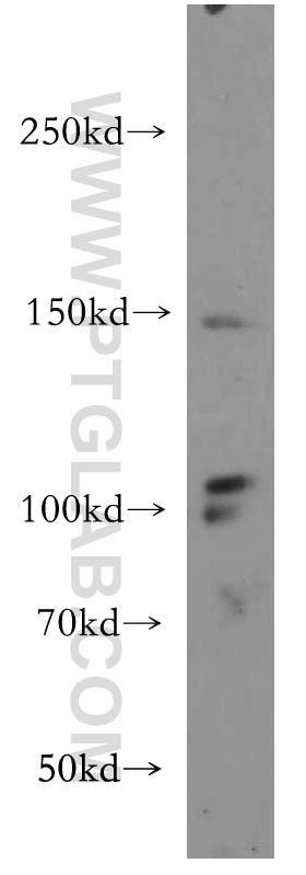 VEGFR3 Polyclonal antibody