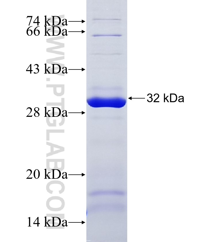 FLT4 fusion protein Ag33909 SDS-PAGE FLT4 fusion protein Ag33909 SDS-PAGE