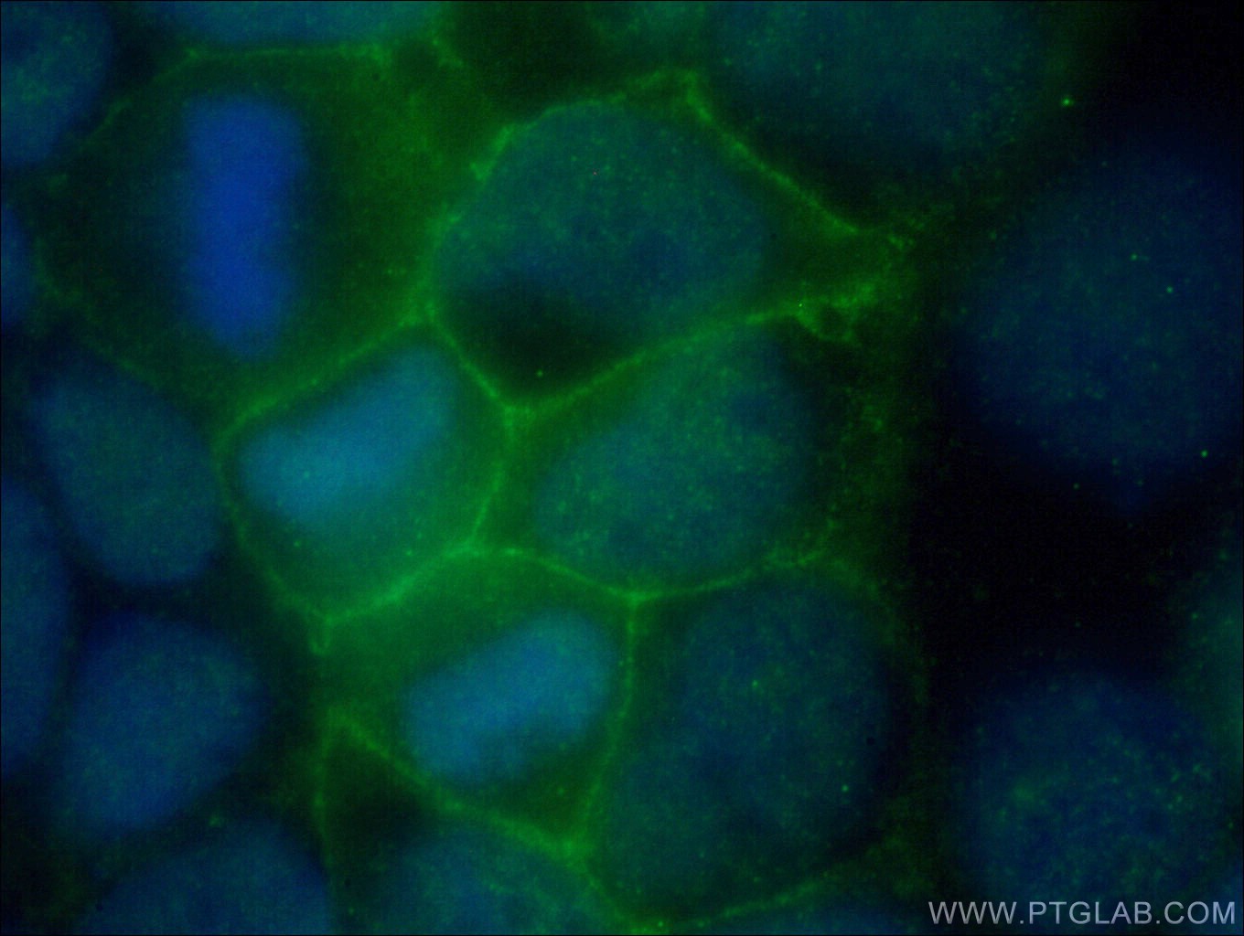 IF Staining of Caco-2 using 26841-1-AP