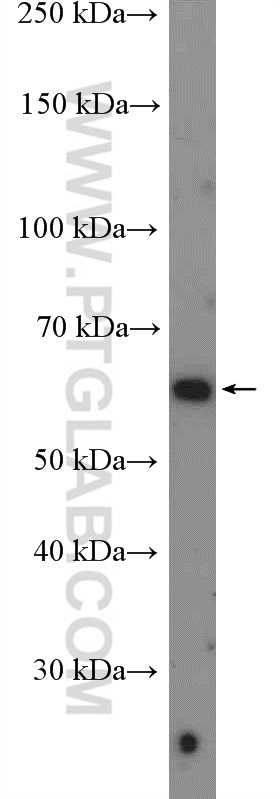 WB analysis of human placenta using 26841-1-AP