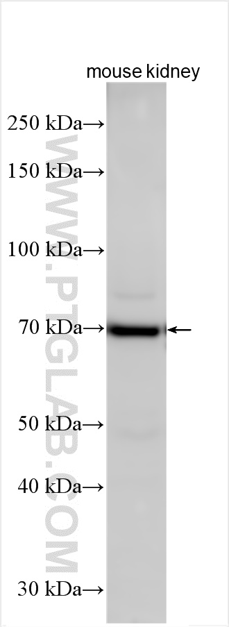 Various lysates were subjected to SDS PAGE followed by western blot with 26841-1-AP (FLVCR1 antibody) at dilution of 1:600 incubated at room temperature for 1.5 hours. WB analysis using 26841-1-AP