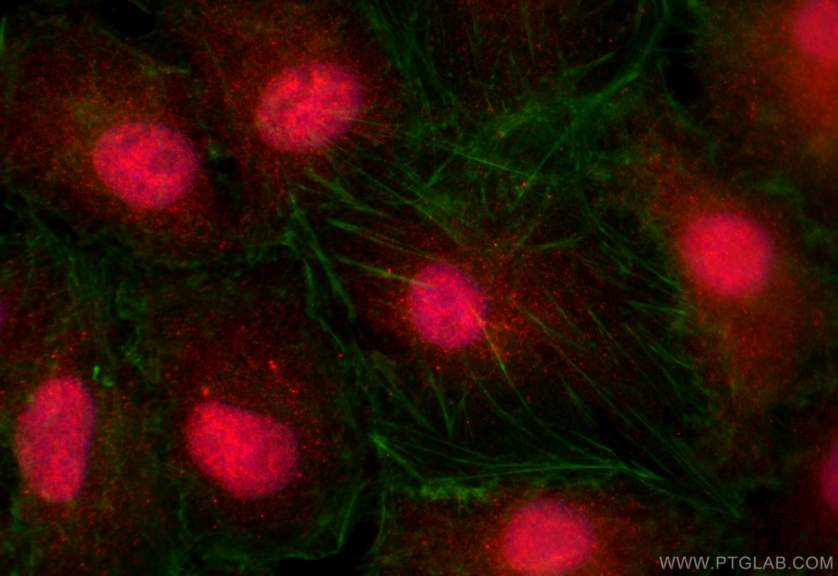 IF Staining of A549 using 25982-1-AP