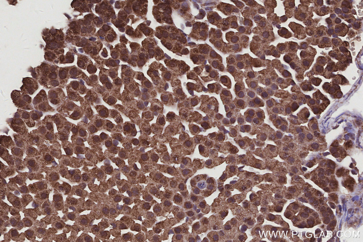 IHC staining of mouse adrenal gland using 11259-1-AP IHC staining of mouse adrenal gland using 11259-1-AP