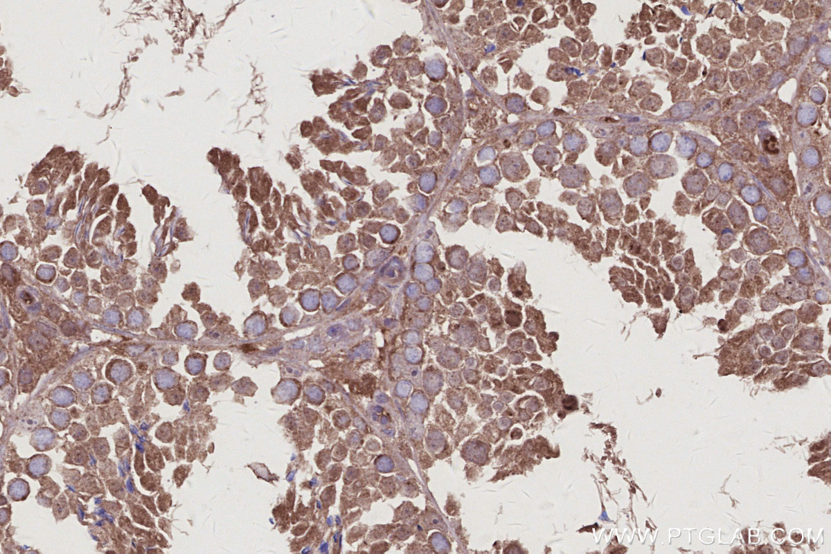 IHC staining of mouse testis using 11259-1-AP IHC staining of mouse testis using 11259-1-AP