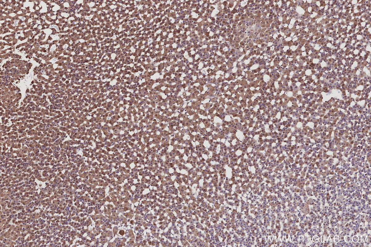 IHC staining of rat adrenal gland using 11259-1-AP IHC staining of rat adrenal gland using 11259-1-AP