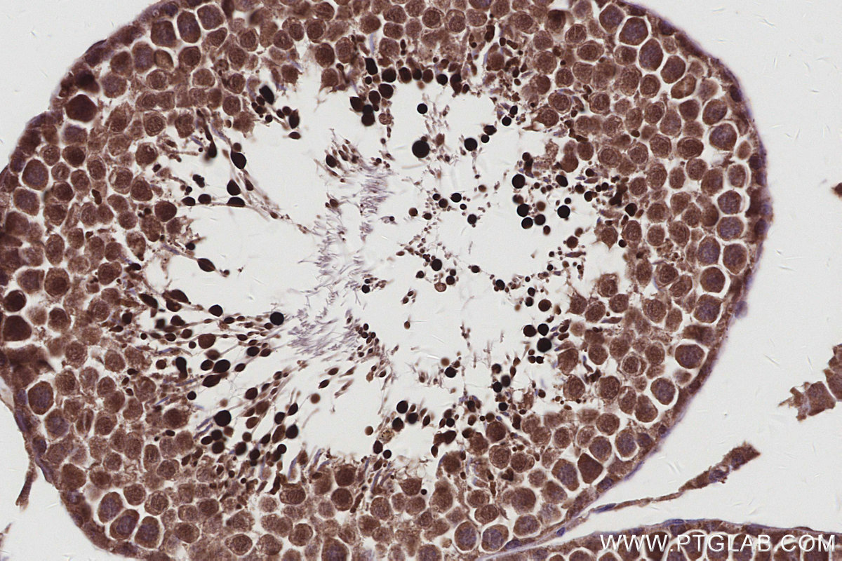IHC staining of rat testis using 11259-1-AP IHC staining of rat testis using 11259-1-AP
