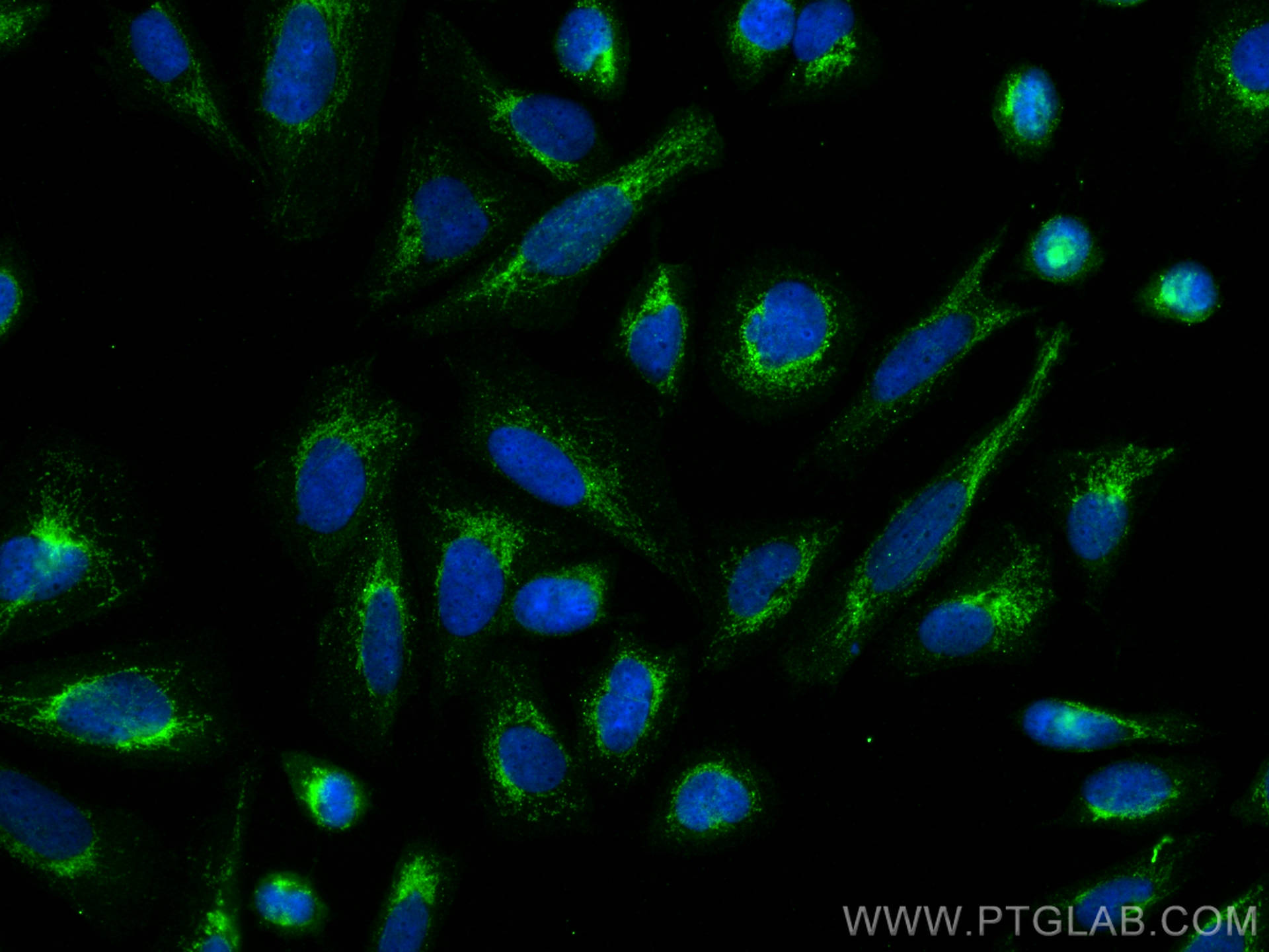 IF Staining of Saos-2 using 10395-1-AP