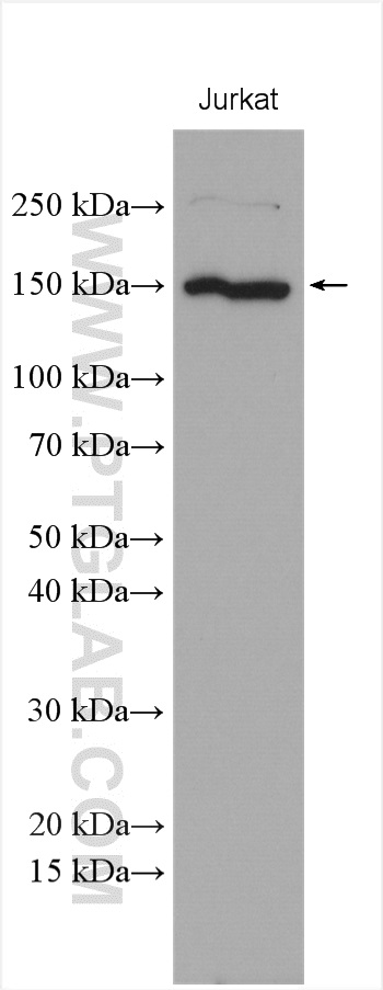 WB analysis using 10395-1-AP