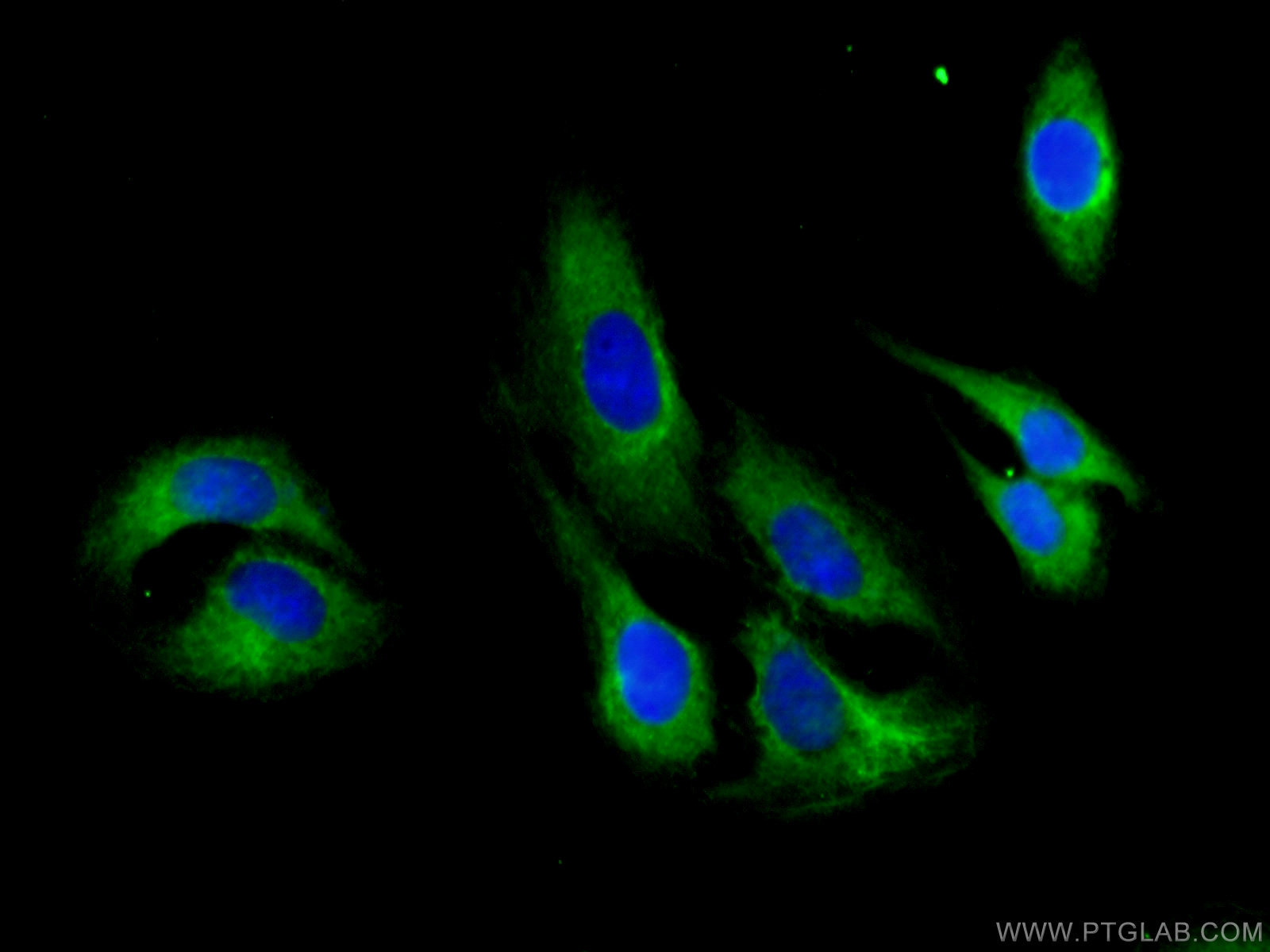 IF Staining of U2OS using 27834-1-AP