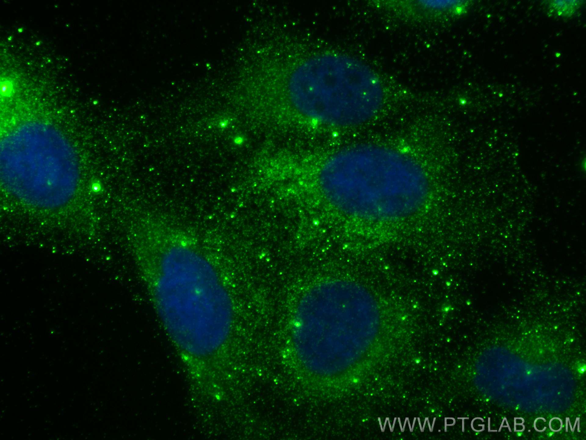 IF Staining of U2OS using 67587-1-Ig (same clone as 67587-1-PBS)