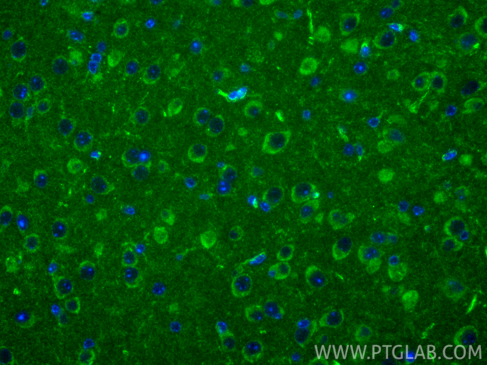 IF Staining of mouse brain using 13038-1-AP IF Staining of mouse brain using 13038-1-AP