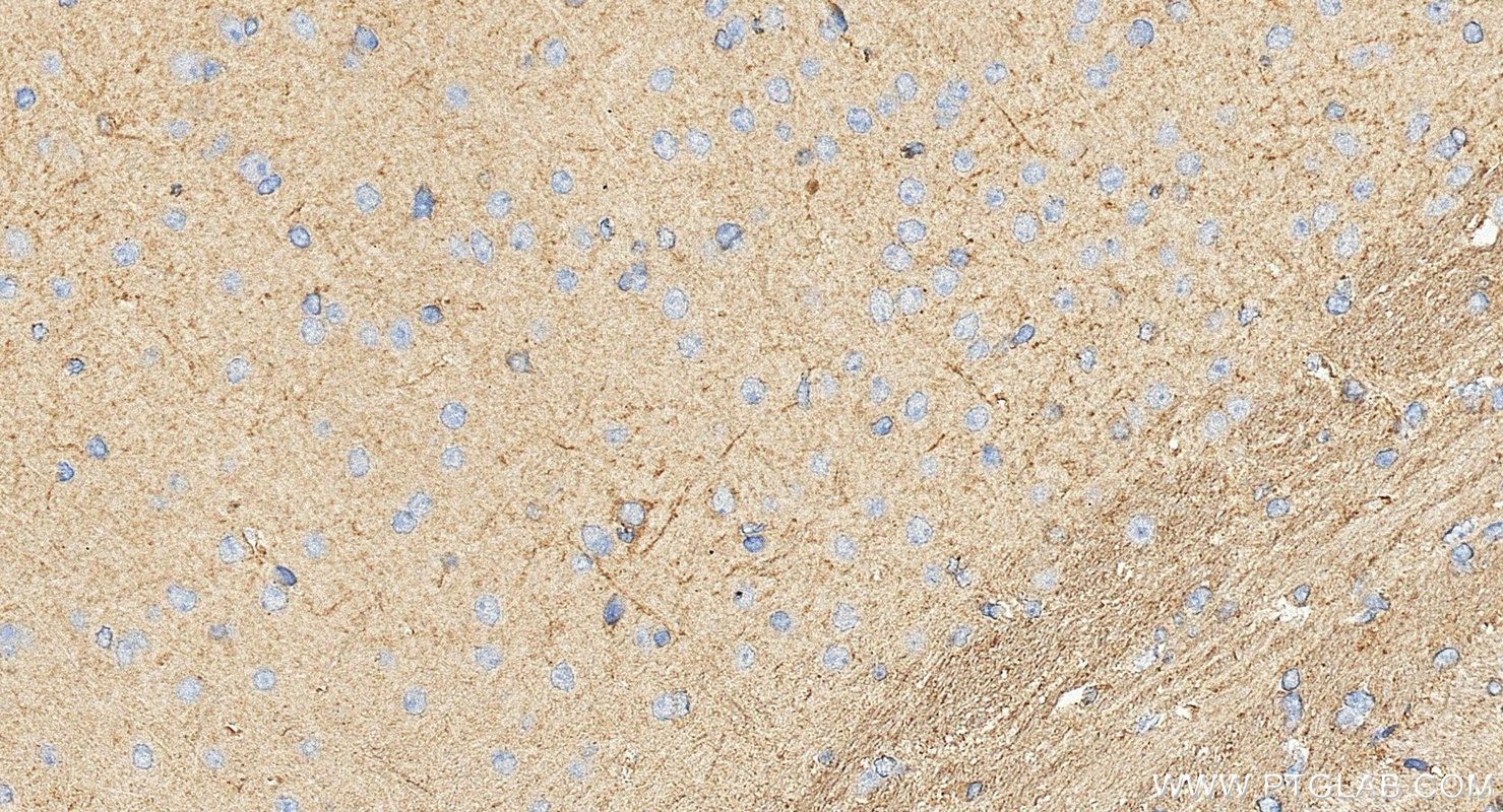 IHC staining of mouse brain using 13038-1-AP IHC staining of mouse brain using 13038-1-AP