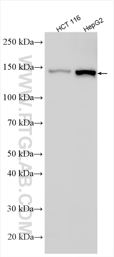 WB analysis using 13038-1-AP WB analysis using 13038-1-AP