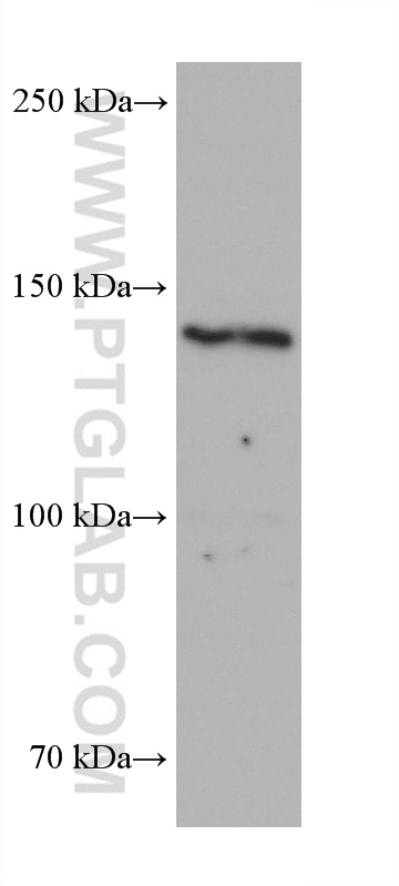 WB analysis of hTERT-RPE1 using 68551-1-Ig (same clone as 68551-1-PBS)