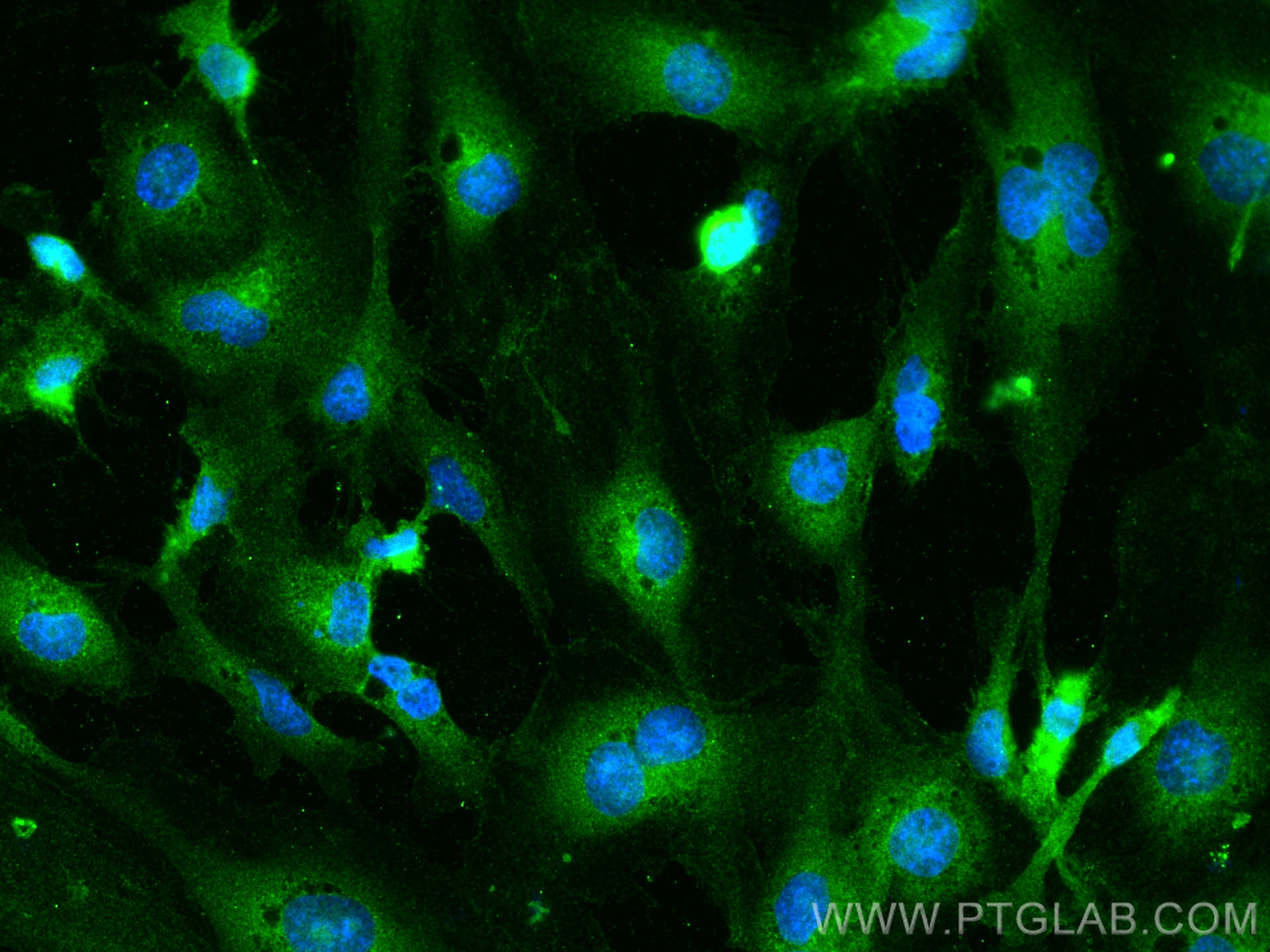 IF Staining of HUVEC using 29756-1-AP (same clone as 29756-1-PBS)