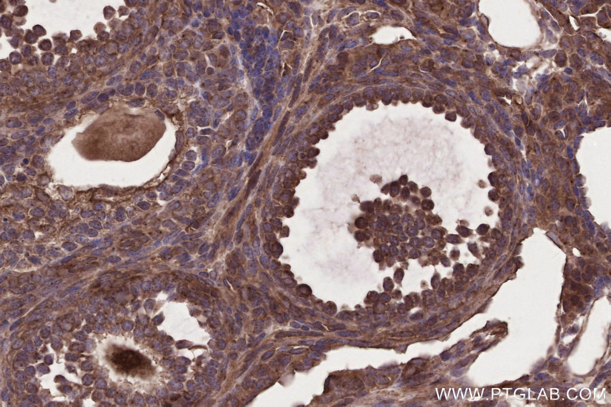 IHC staining of mouse ovary using 29756-1-AP IHC staining of mouse ovary using 29756-1-AP